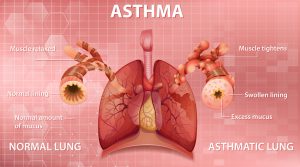 Astma en homeopathie